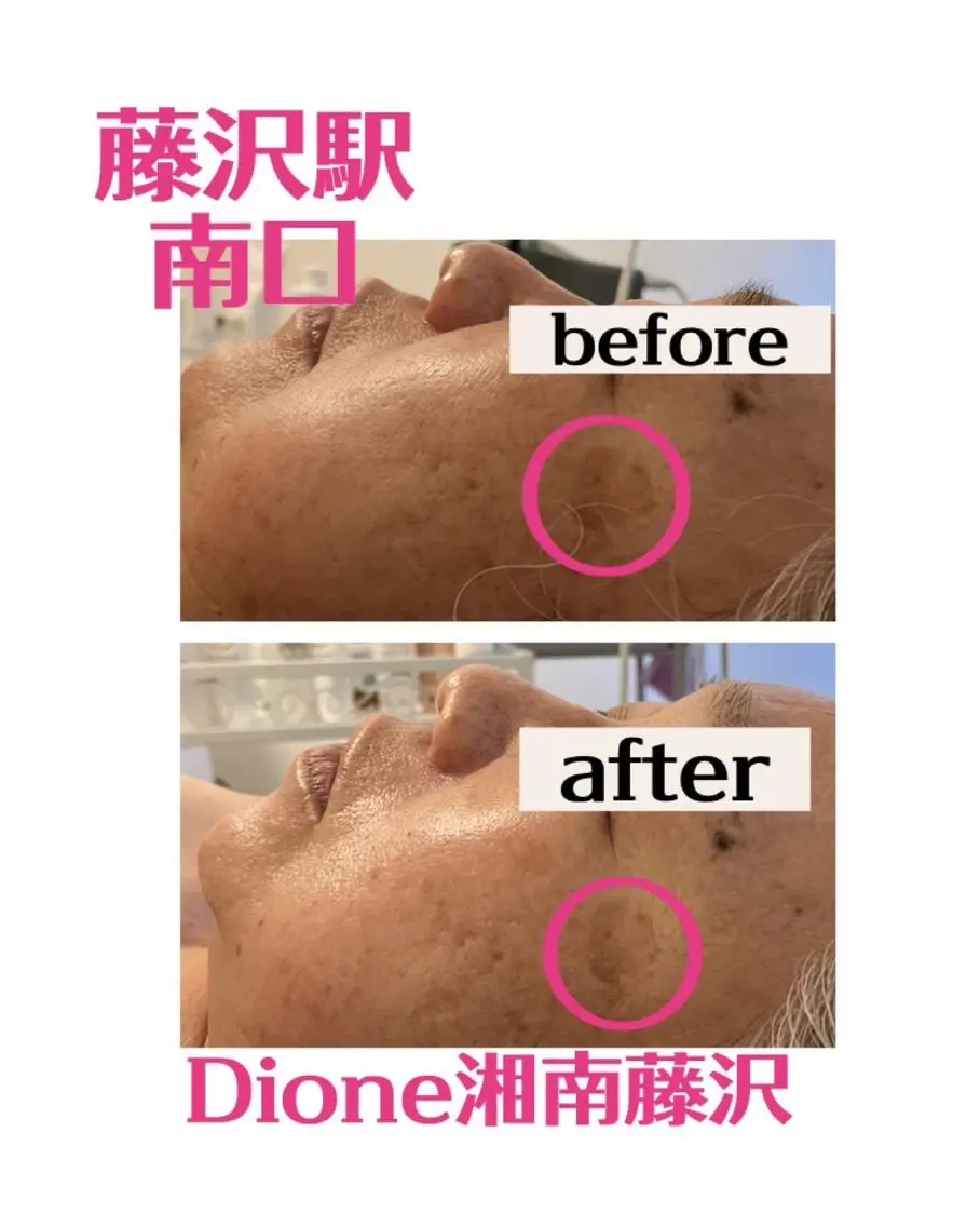 LUANA 美肌脱毛＋Skinのエステ・リラクイメージ