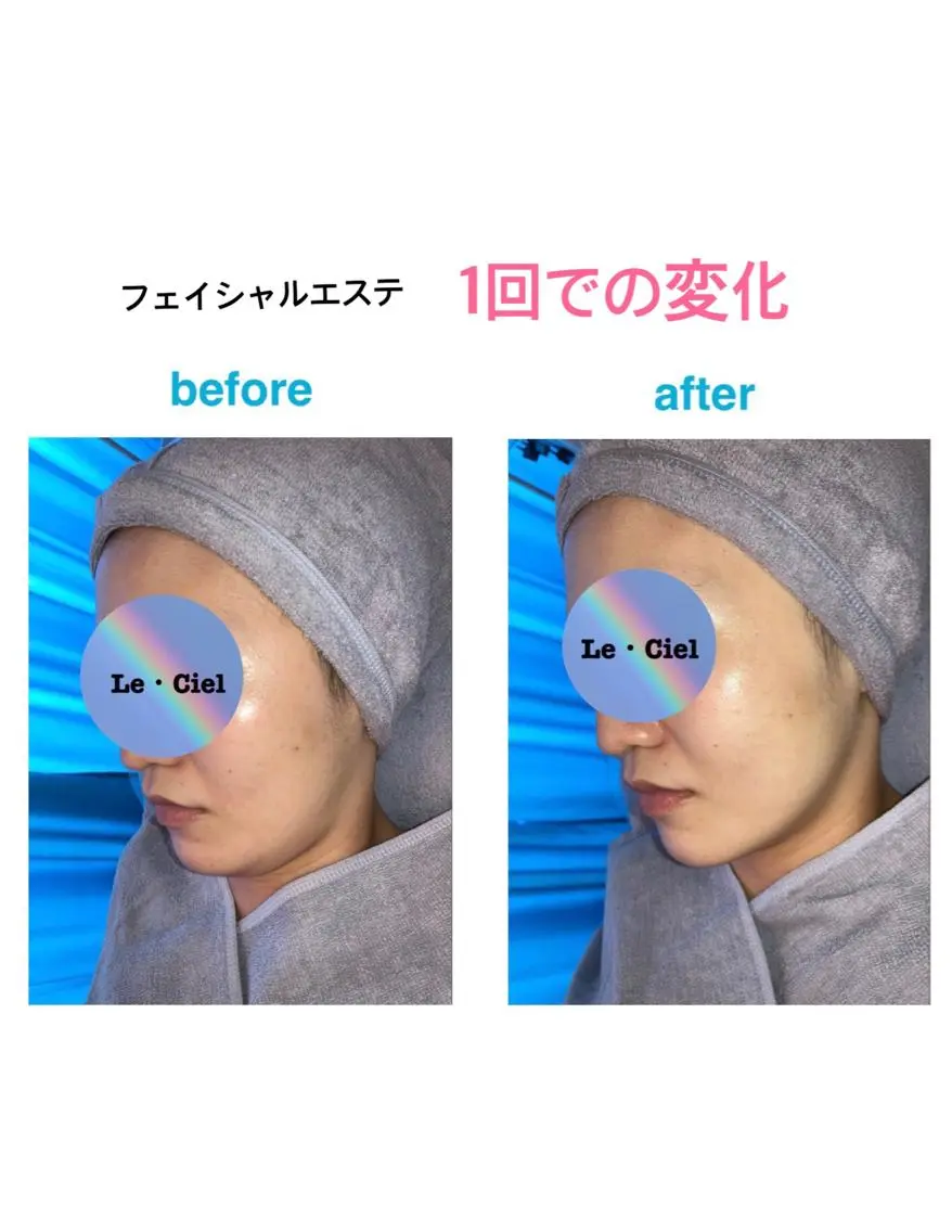 Le・Ciel フェイシャル&ボディのエステ・リラクイメージ