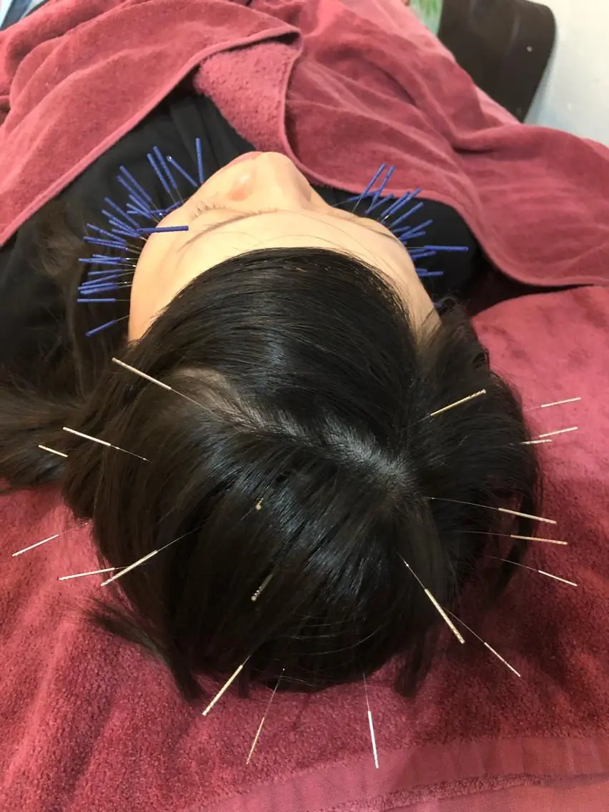 エステ リラク 美容鍼灸女性専用 りんご鍼灸治療院のその他イメージ