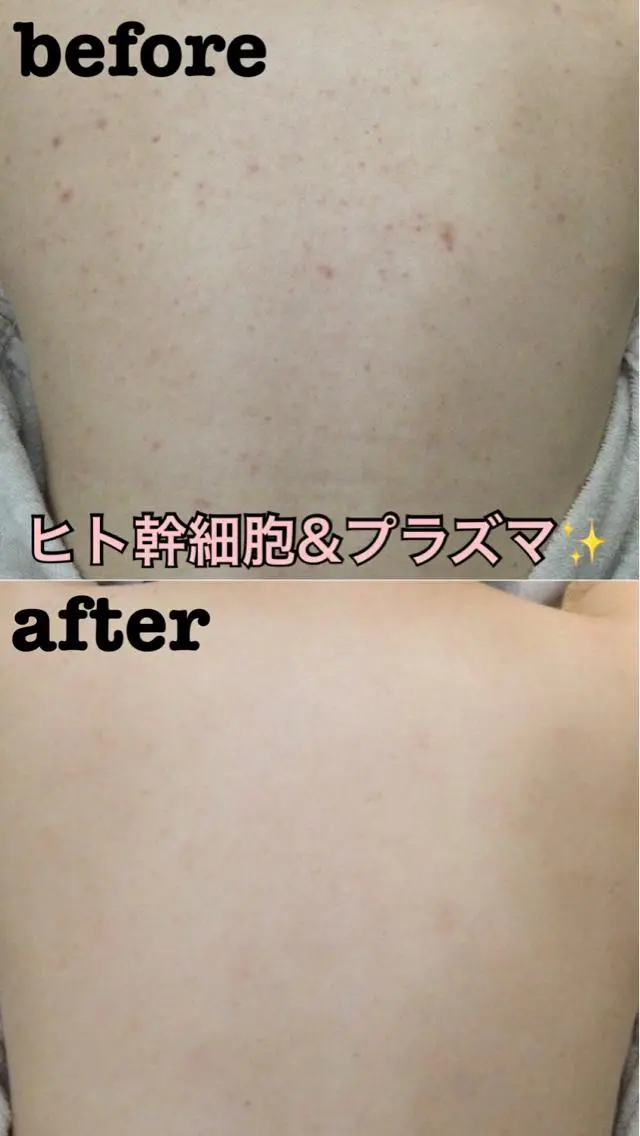 エステ ネイル＆毛穴肌質改善 salon♪南森町のエステ・リラクイメージ