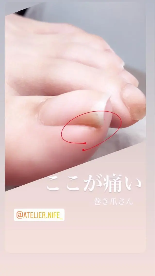 ネイル フットネイル atelier nife.のネイルデザイン
