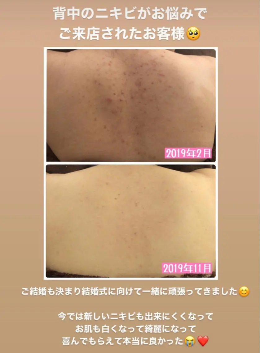 ミディアム カラー パーマ ヘアアレンジ メンズ キッズ ネイル マツエク・マツパ エステ リラク ニキビ・肌質改善専門 ♡人生が変わるサロンのエステ・リラクイメージ