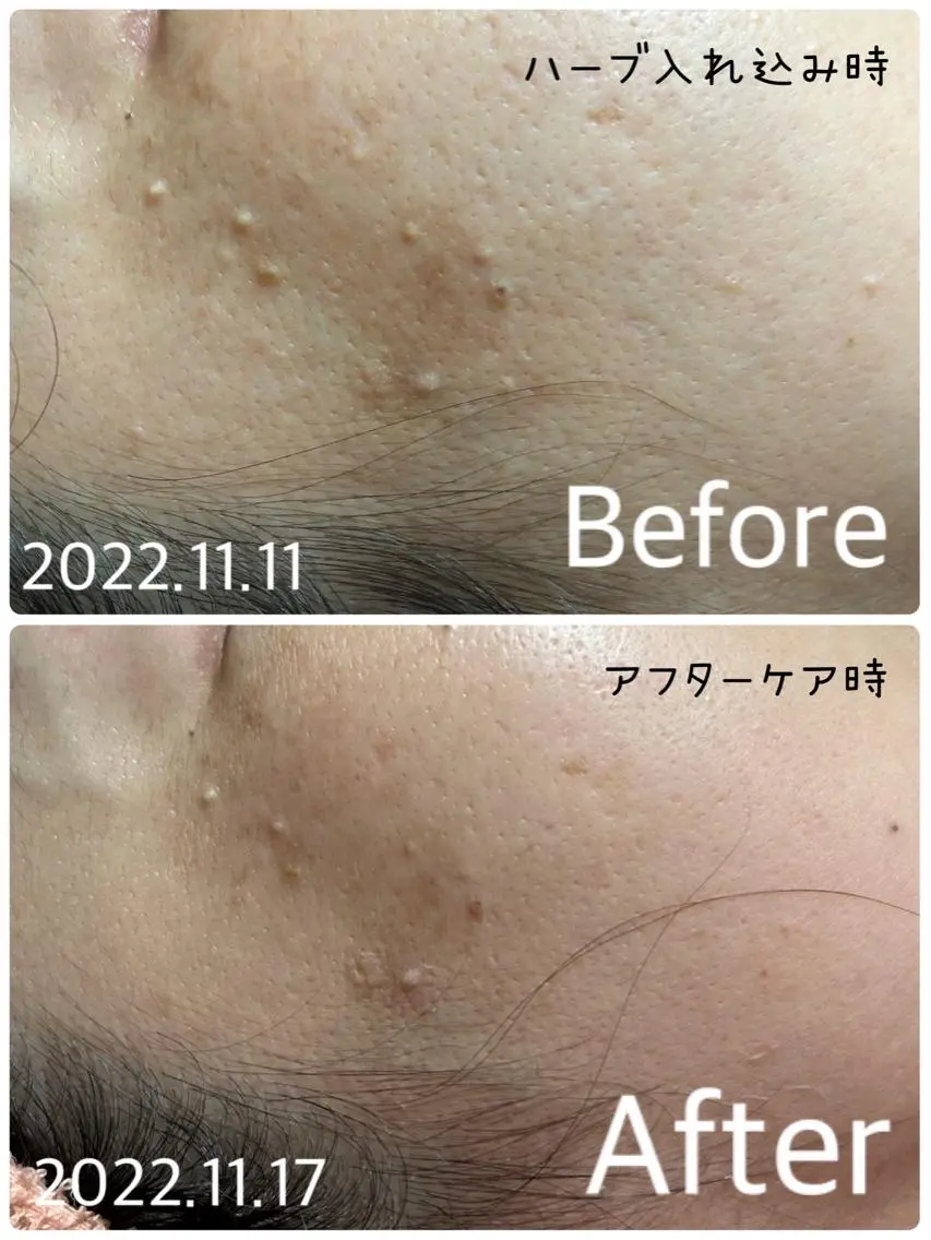 エステ デトックス専門サロン ココシュエットのエステ・リラクイメージ