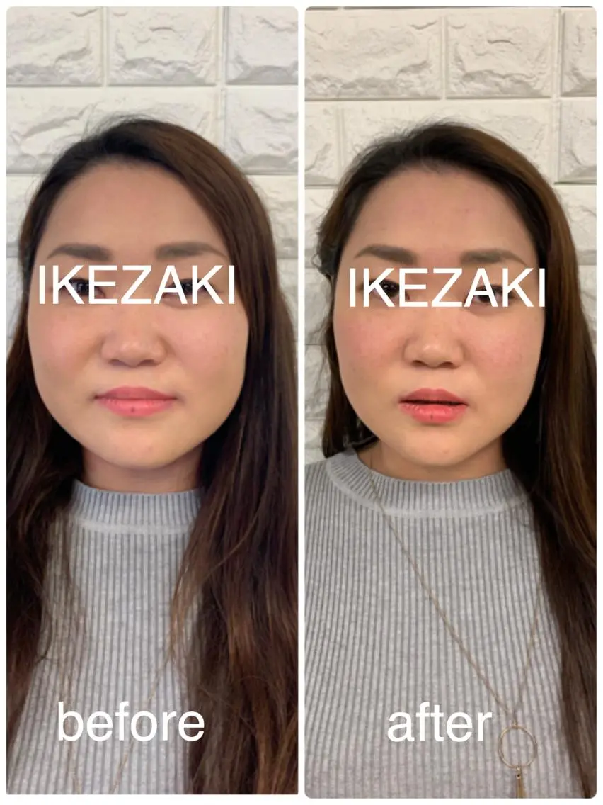 美容鍼 IKEZAKIのエステ・リラクイメージ