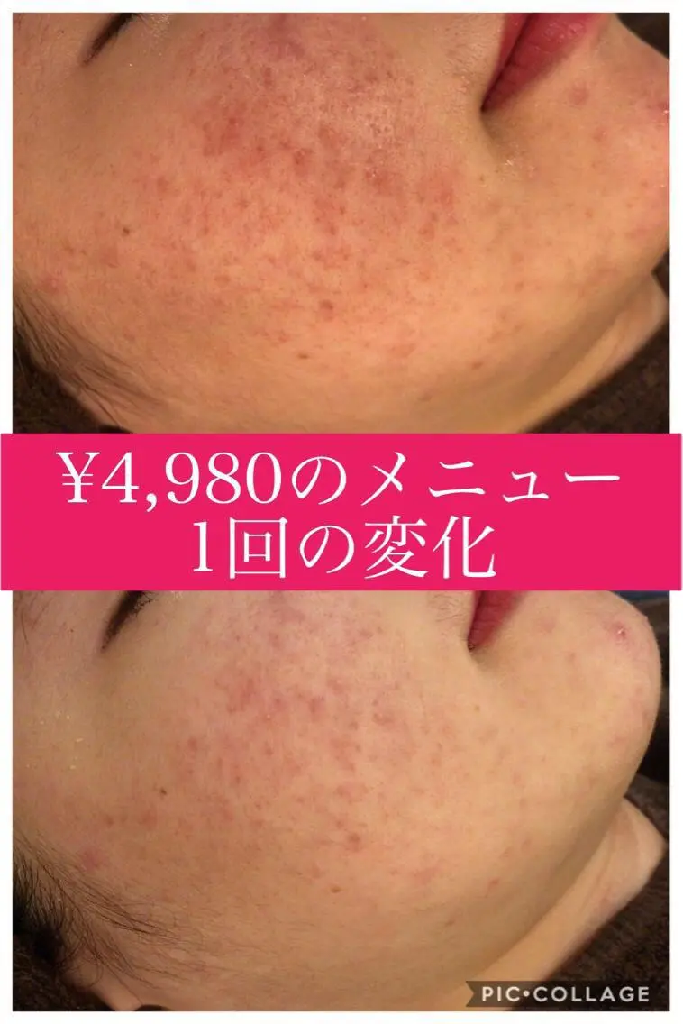 ショート カラー パーマ ヘアアレンジ メンズ キッズ ネイル マツエク・マツパ ニキビ・肌質改善専門 ♡人生が変わるサロンのエステ・リラクイメージ
