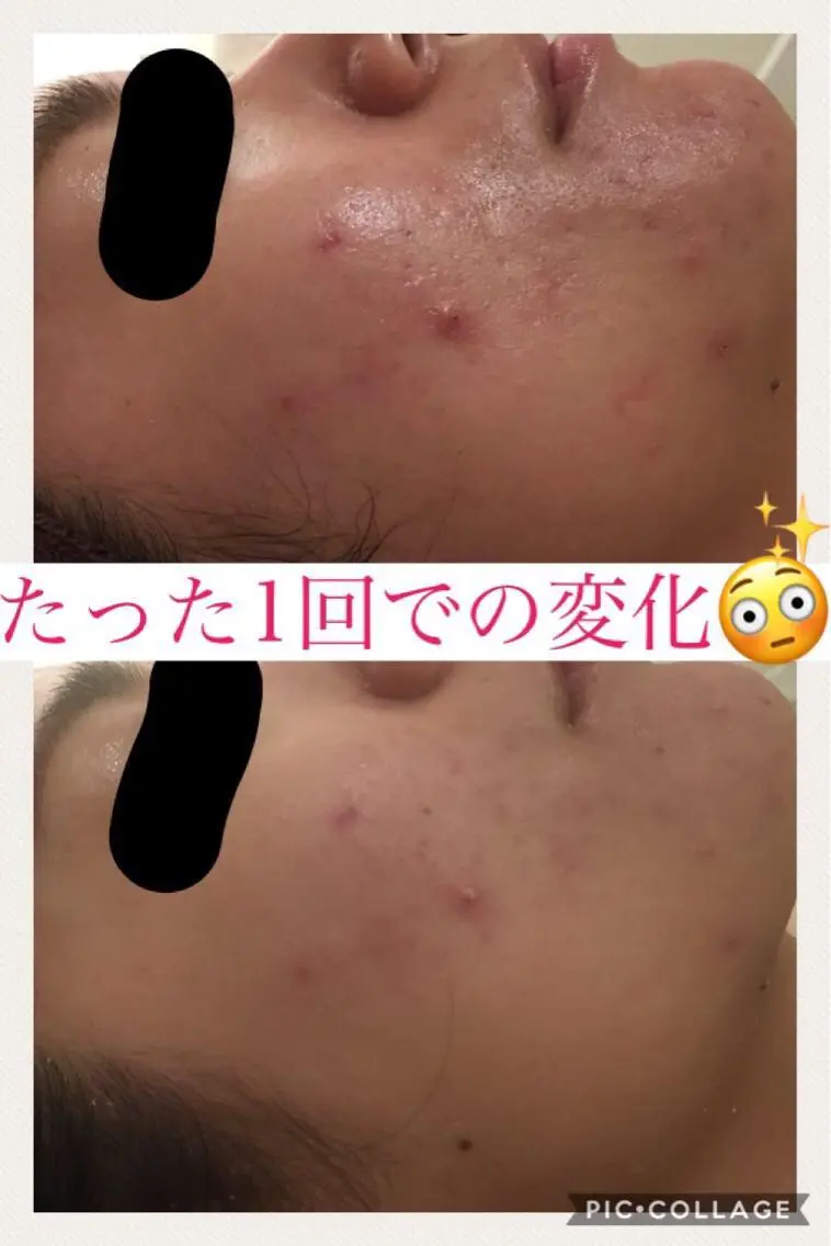 ミディアム カラー パーマ ヘアアレンジ メンズ キッズ ネイル マツエク・マツパ エステ リラク ニキビ・肌質改善専門 ♡人生が変わるサロンのエステ・リラクイメージ