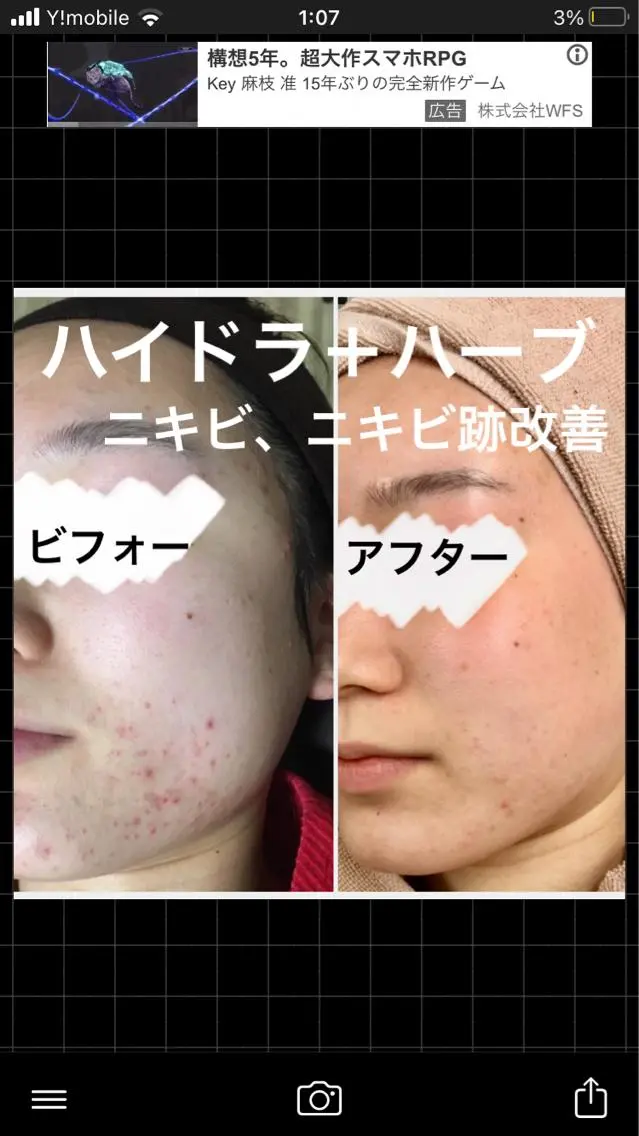 セミロング カラー パーマ ヘアアレンジ メンズ キッズ ネイル マツエク・マツパ アイブロウ 春ネイル エステ ハーブピーリング専門 🌿モッカのエステ・リラクイメージ