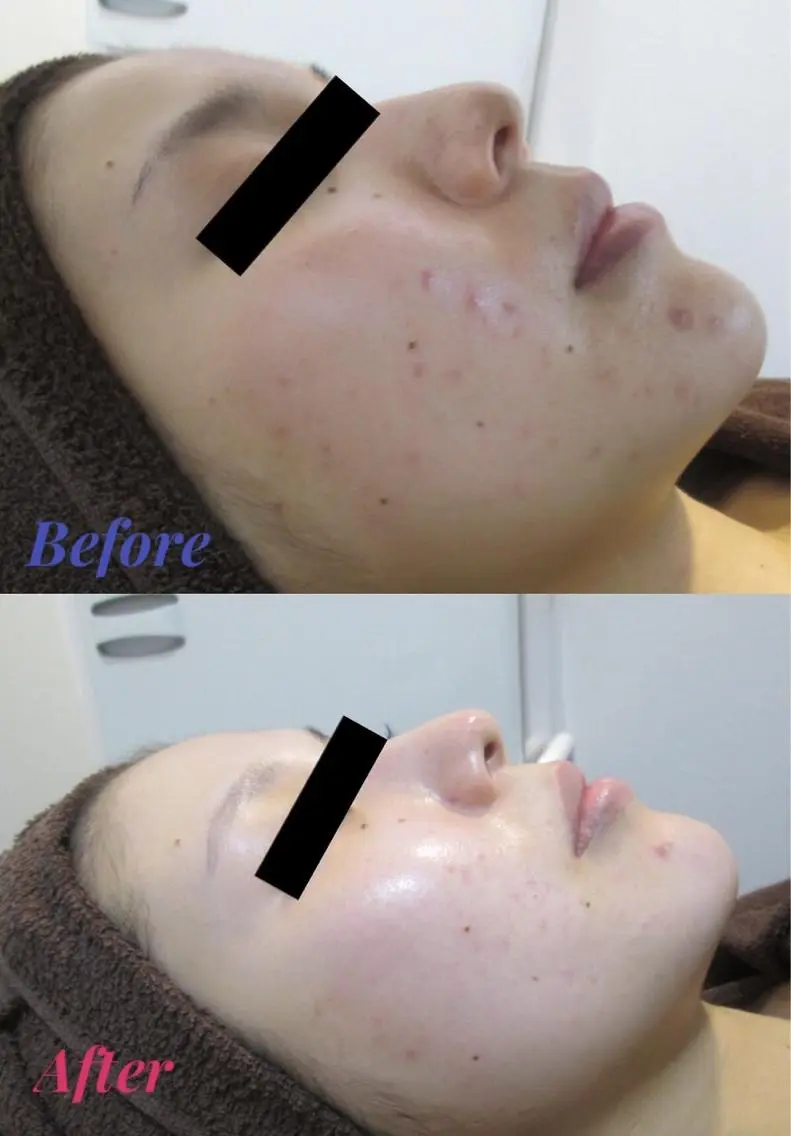 Life Salon別府店のエステ・リラクイメージ