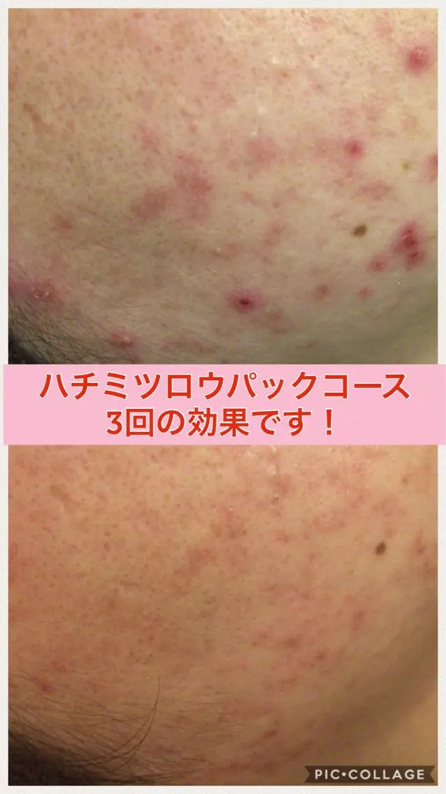 ショート カラー パーマ ヘアアレンジ メンズ キッズ ネイル マツエク・マツパ ニキビ・肌質改善専門 ♡人生が変わるサロンのエステ・リラクイメージ