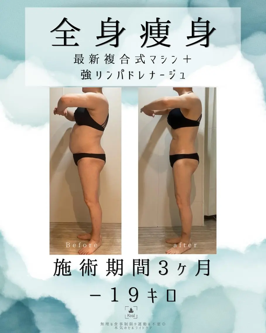 エステ 医療提携 肌管理痩身エステ池袋のエステ・リラクイメージ