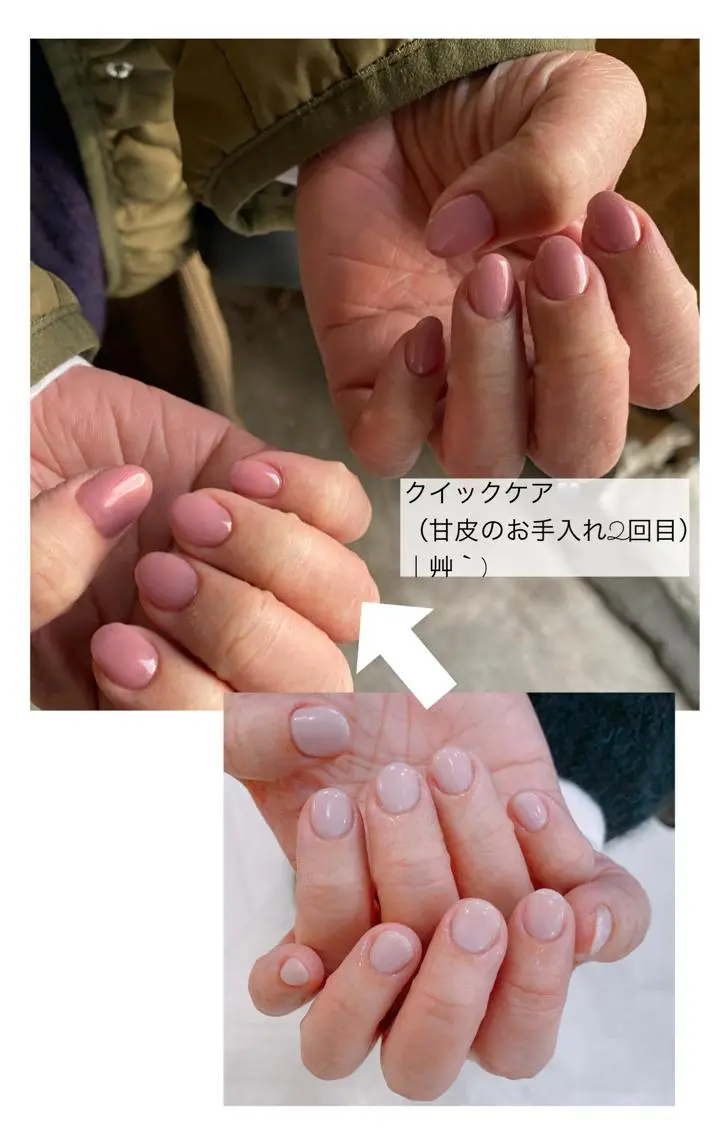 ネイル nailsalon ∞ ﾐｶﾅﾙ ∞のネイルデザイン