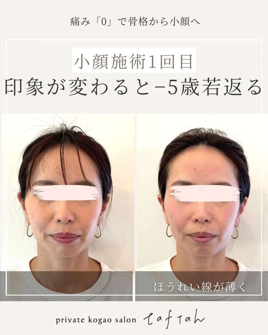 小顔   目元専門 taftahタフタのマツエク・マツパデザイン