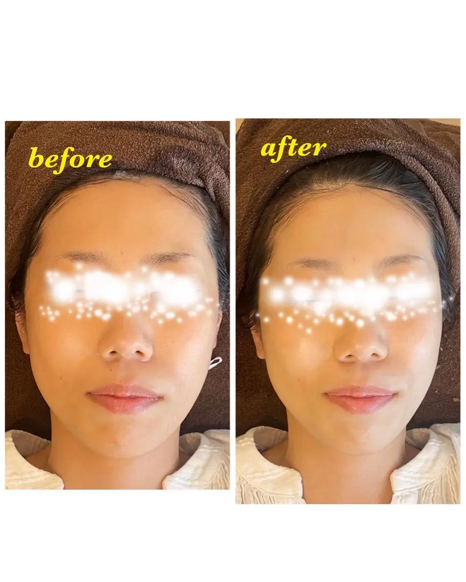ハーブピーリング専門 毛穴洗浄❤️眉waxのエステ・リラクイメージ