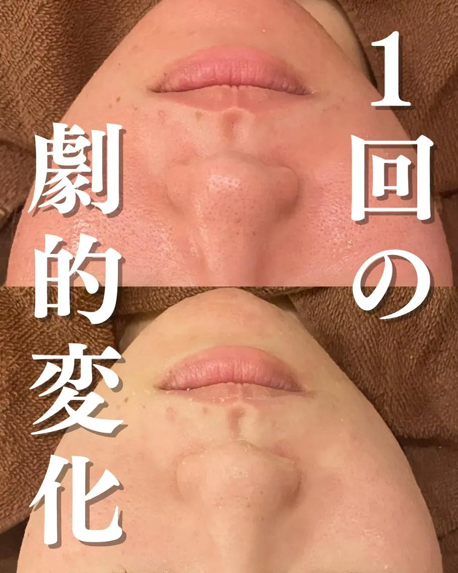 エステ リラク 美容まるっと ビヨマルのエステ・リラクイメージ