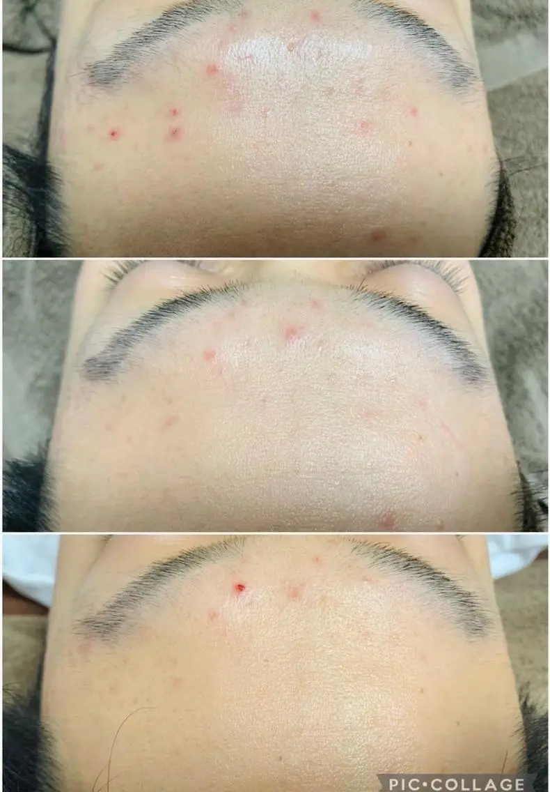 ロング カラー パーマ ヘアアレンジ メンズ キッズ ネイル マツエク・マツパ アイブロウ 肌質体質を変えて すっぴん肌にのエステ・リラクイメージ