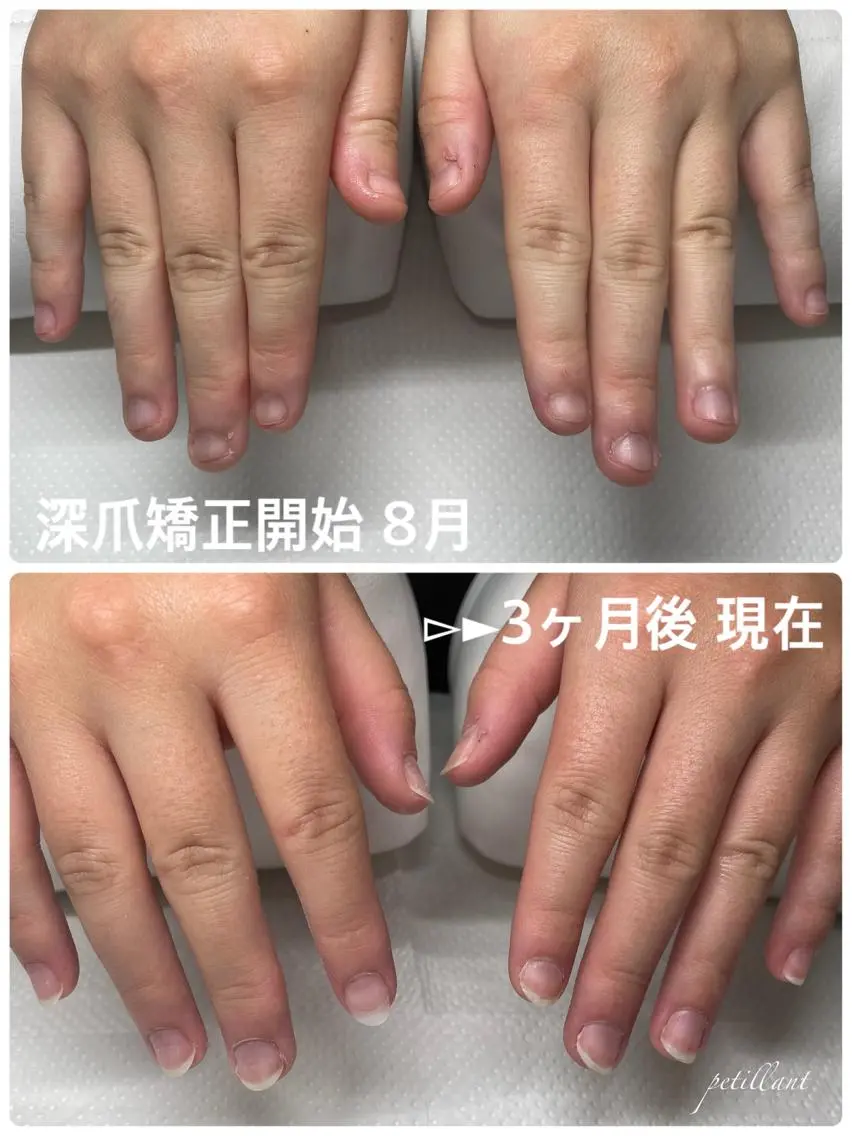 ネイル 長さ出し ピンク nail salon petillantのネイルデザイン