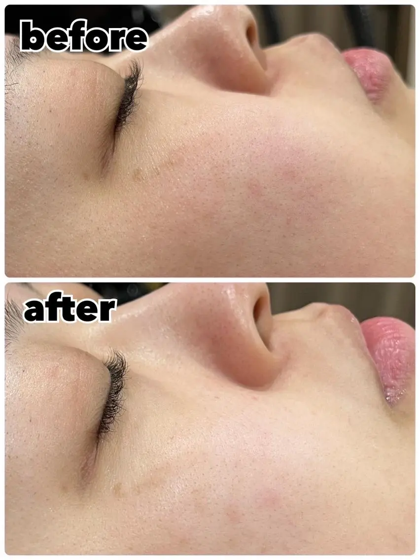エステ レイビス 渋谷店中野🤍のエステ・リラクイメージ