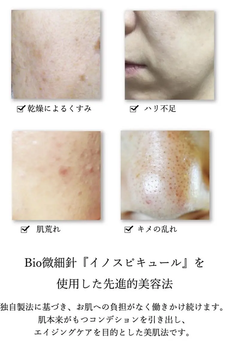 エステ EYE LASH LAPISのエステ・リラクイメージ
