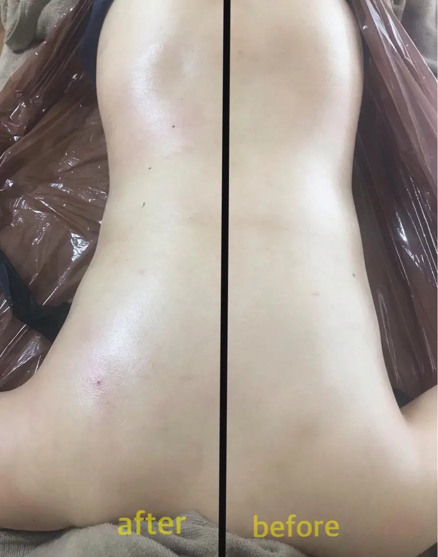 《本気痩せ×疲労改善 》  BILOOPのエステ・リラクイメージ