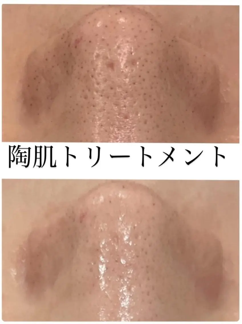 エステ リラク 疲れ顔卒業✨肩こり 改善×小顔サロン 岡のエステ・リラクイメージ