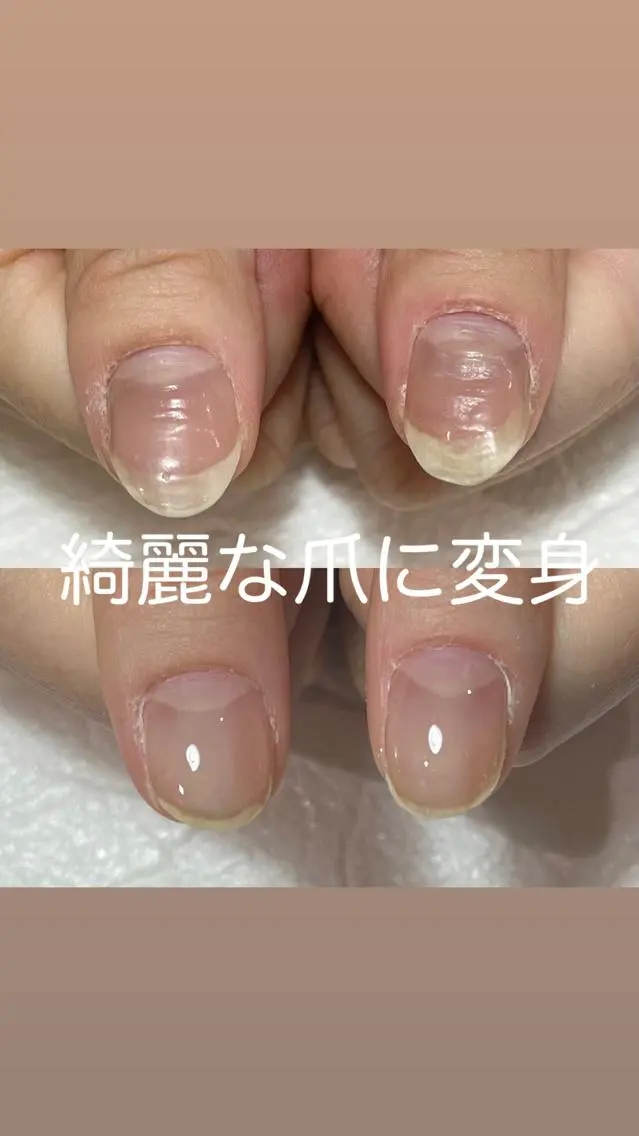 ネイル 自爪育成・巻き爪 補正講師 津蔵のネイルデザイン