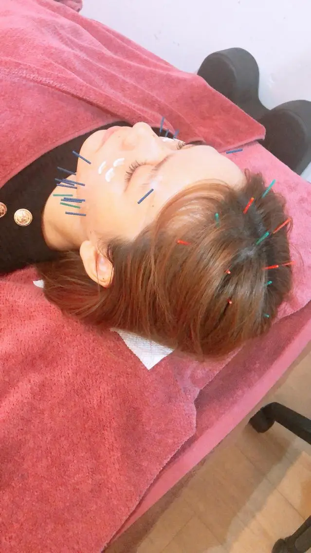 美容鍼灸女性専用 りんご鍼灸治療院のその他イメージ