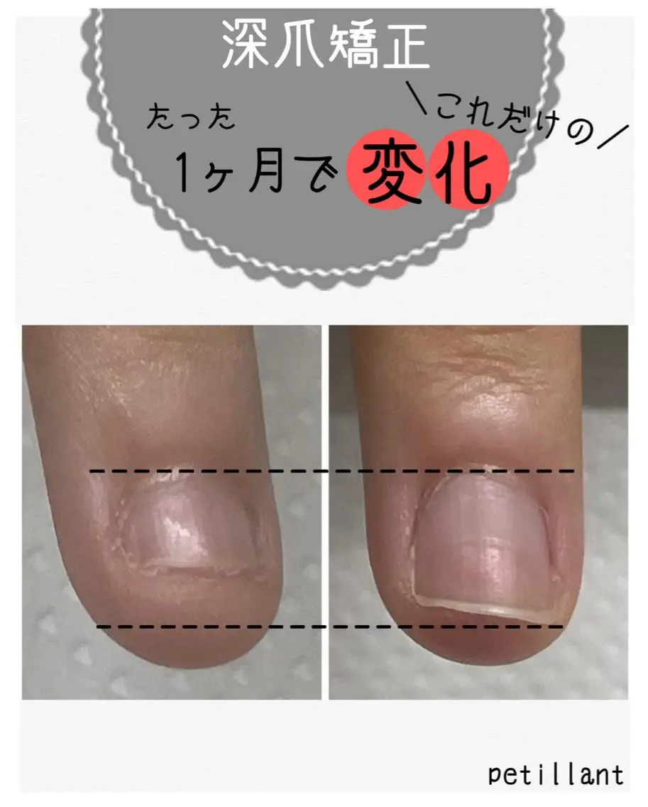ネイル 長さ出し ピンク nail salon petillantのネイルデザイン