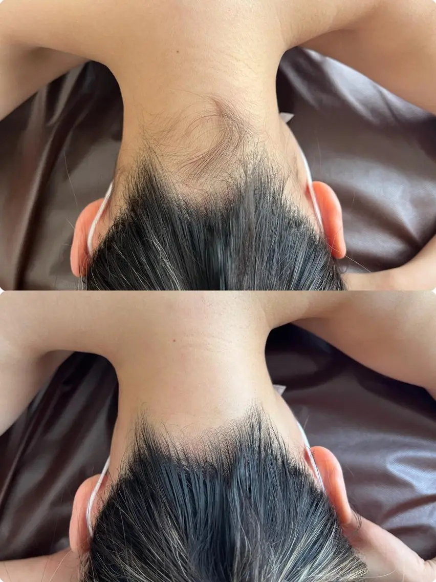 毛穴/シミ肝斑/脱毛 横山梨里のエステ・リラクイメージ