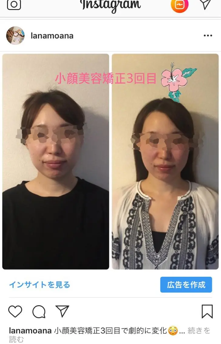 Lana moana spa🌺のエステ・リラクイメージ