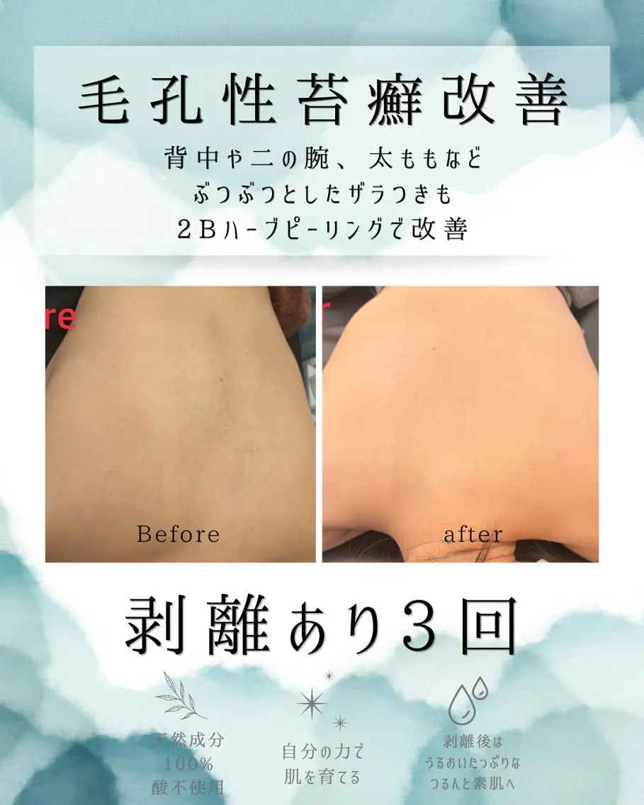 エステ リラク 医療提携 肌管理痩身エステ池袋のエステ・リラクイメージ