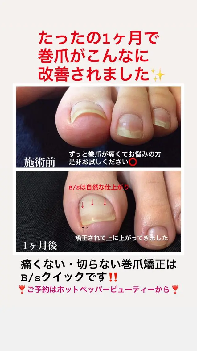 ネイル Viseo《6週間 長持ちパラジェル》のネイルデザイン