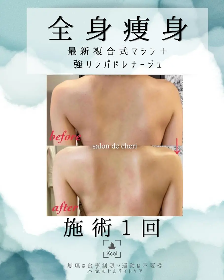 エステ 医療提携 肌管理痩身エステ池袋のエステ・リラクイメージ