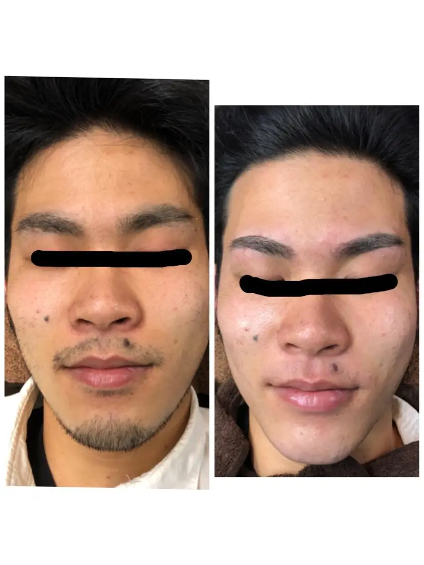 脱毛 兒玉 知代の眉毛・アイブロウイメージ