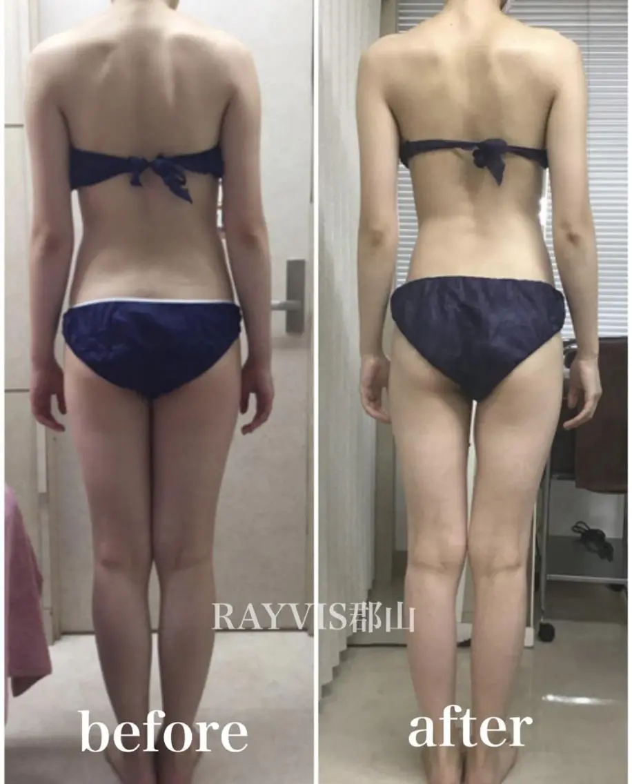 RAYVIS 郡山店 小野のエステ・リラクイメージ