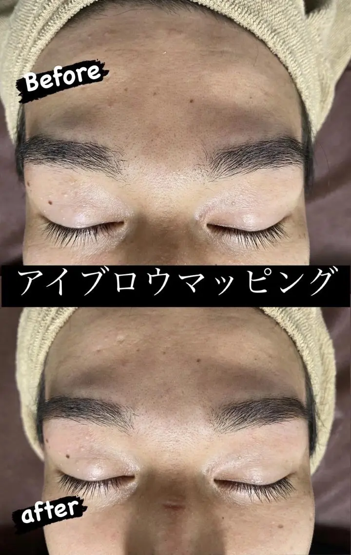 キッズ メンズ ワックス脱毛 Epina 千葉店 【エピナ】のエステ・リラクイメージ