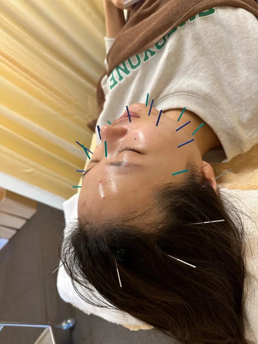 その他 鍼灸サロン BBB3のその他イメージ