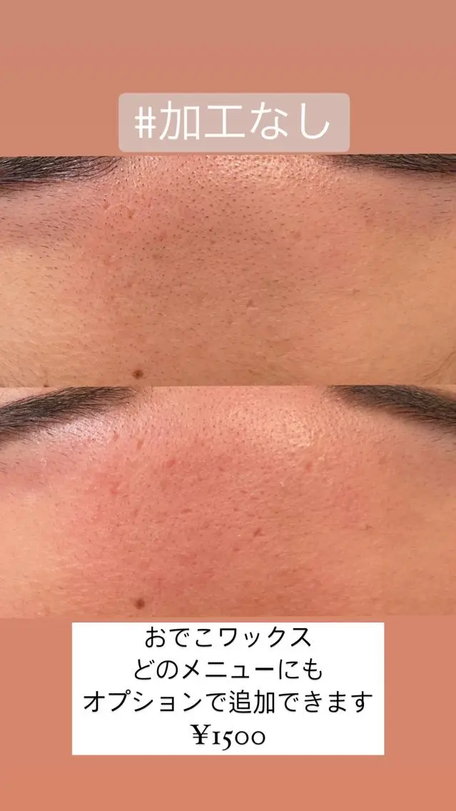 脱毛 森崎 麗のマツエク・マツパデザイン