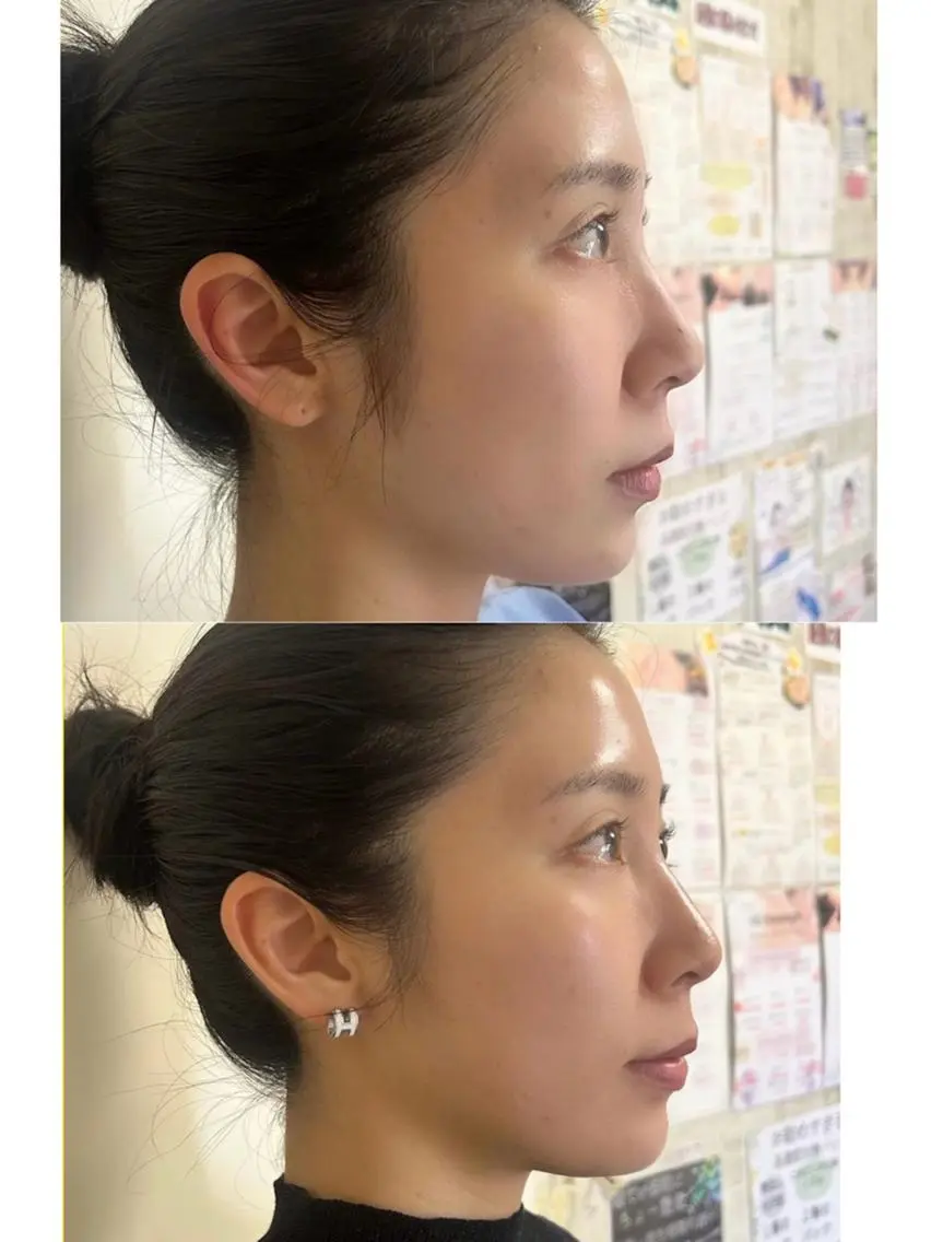 佐藤 咲希のその他イメージ