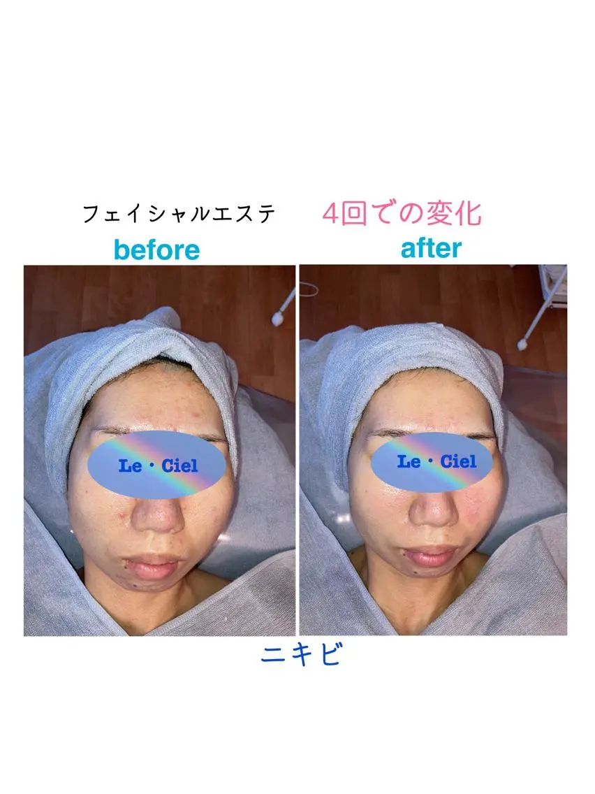 Le・Ciel フェイシャル&ボディのエステ・リラクイメージ