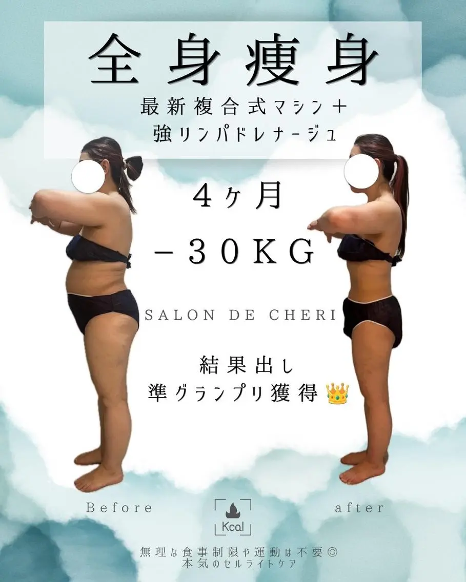 エステ 医療提携 肌管理痩身エステ池袋のエステ・リラクイメージ