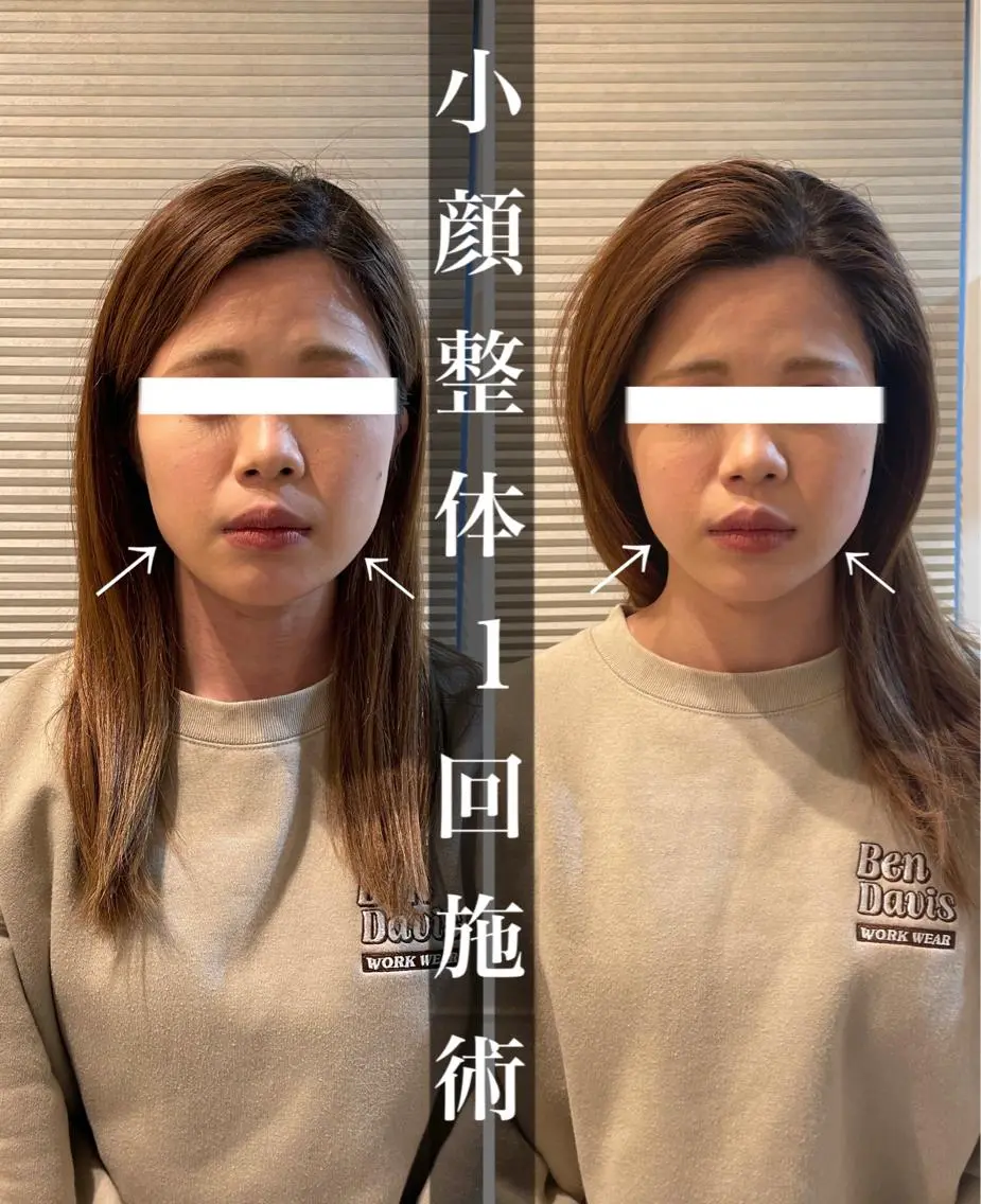 鍼灸 Refineのその他イメージ