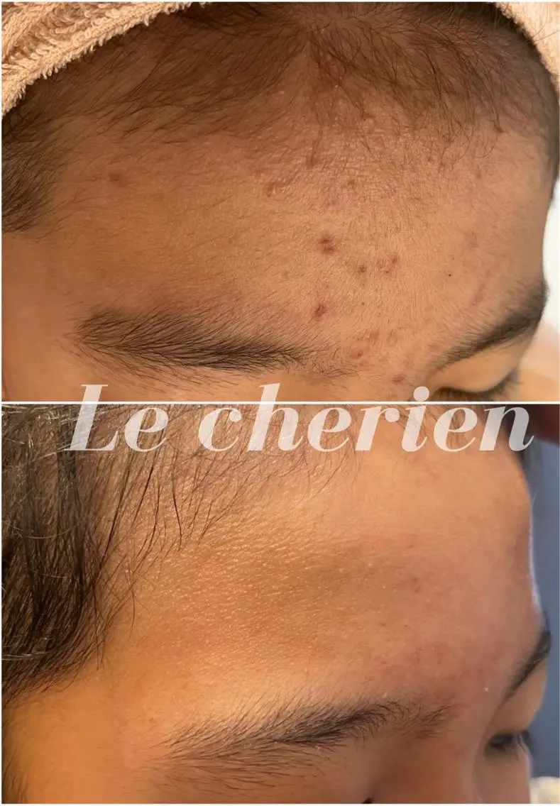 エステ Le cherien ルシェリアのエステ・リラクイメージ