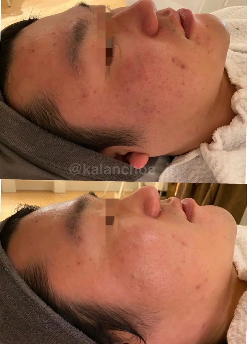 エステ 肌質改善 KALANCHOEのエステ・リラクイメージ