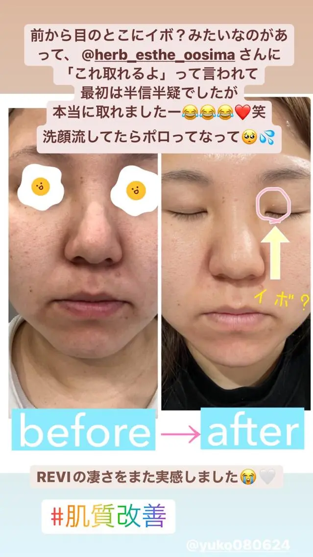 エステ 肌育脱毛サロン LikoLinaのその他イメージ