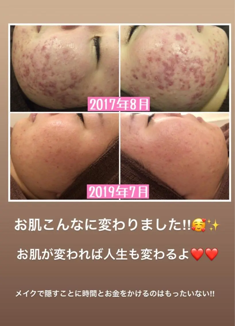 ミディアム カラー パーマ ヘアアレンジ メンズ キッズ ネイル マツエク・マツパ エステ リラク ニキビ・肌質改善専門 ♡人生が変わるサロンのエステ・リラクイメージ