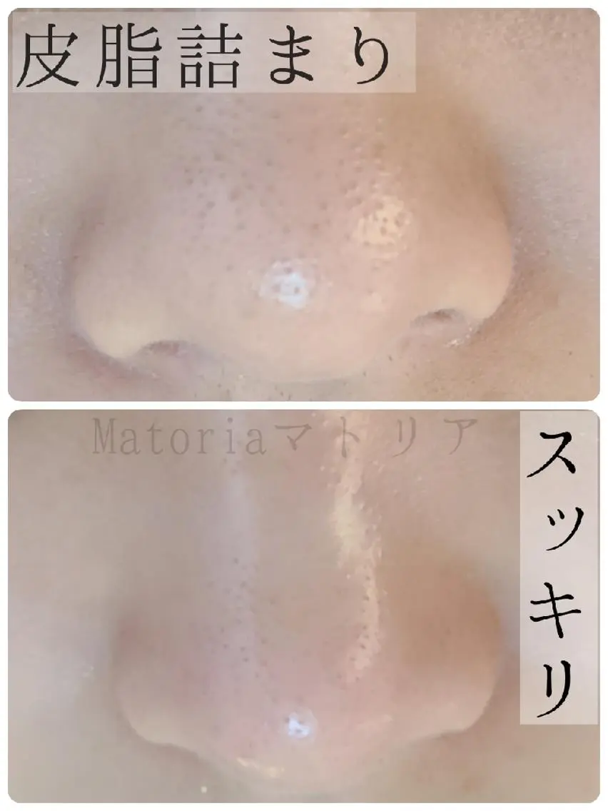 エステ 小顔 美肌専門 Matoriaのエステ・リラクイメージ