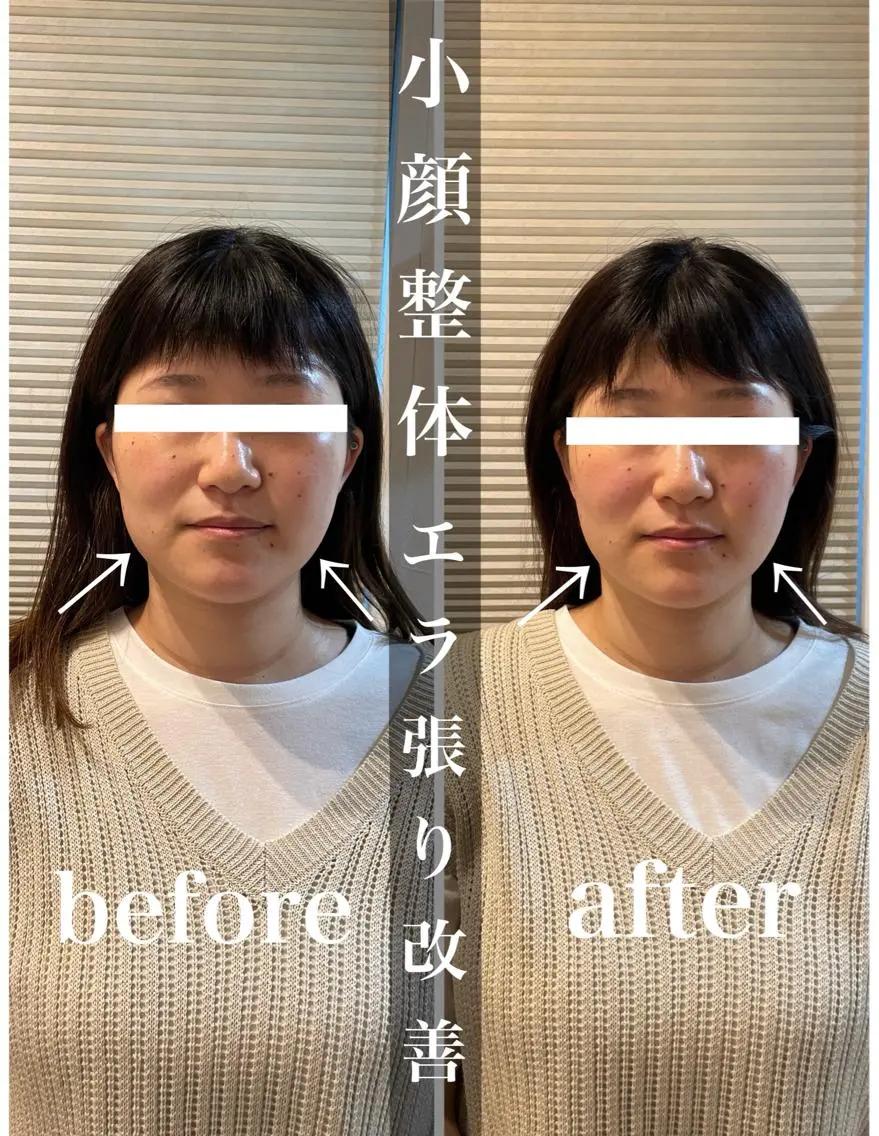 鍼灸 Refineのその他イメージ