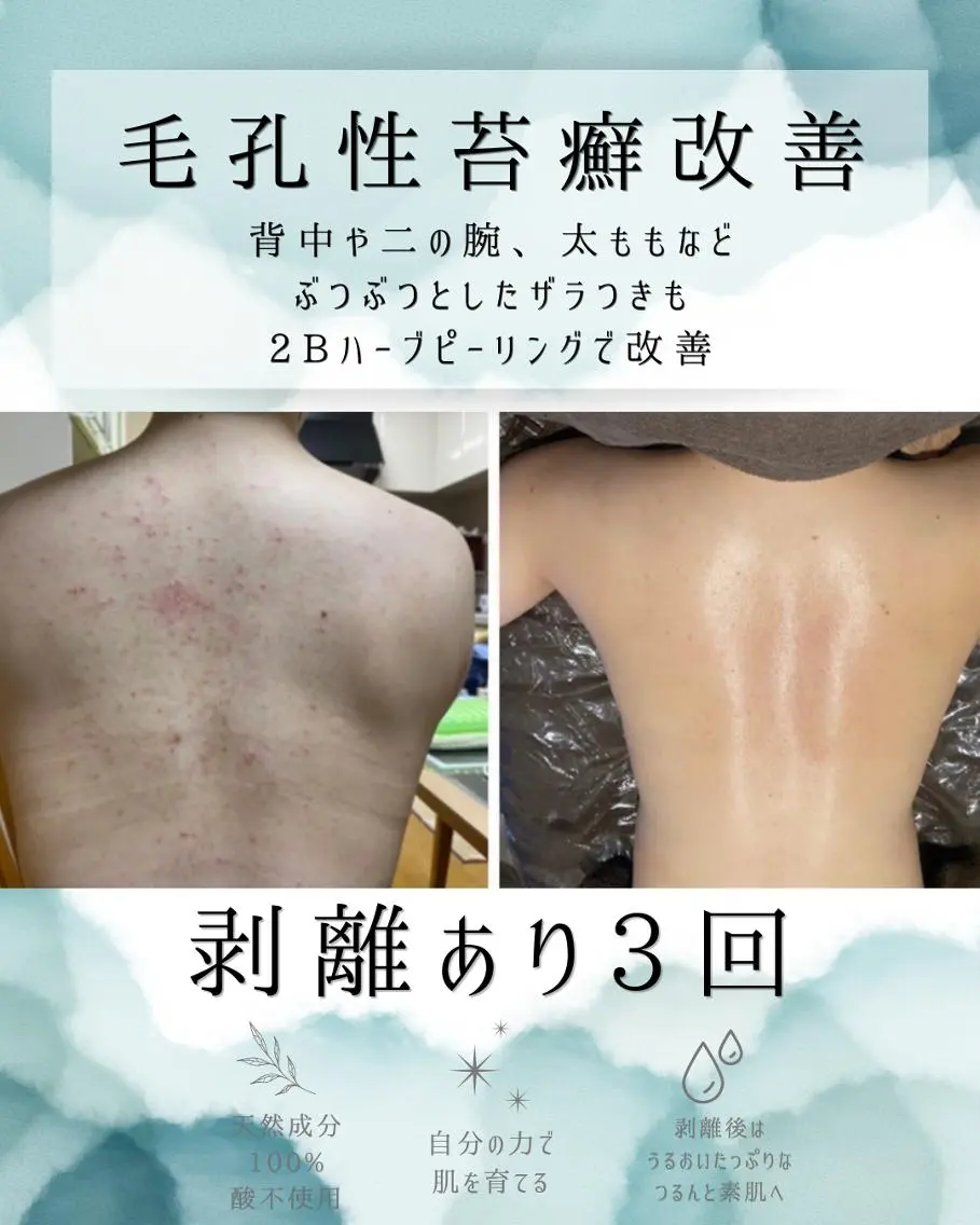 エステ リラク 医療提携 肌管理痩身エステ池袋のエステ・リラクイメージ