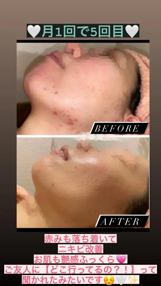 Lana moana spa🌺のエステ・リラクイメージ