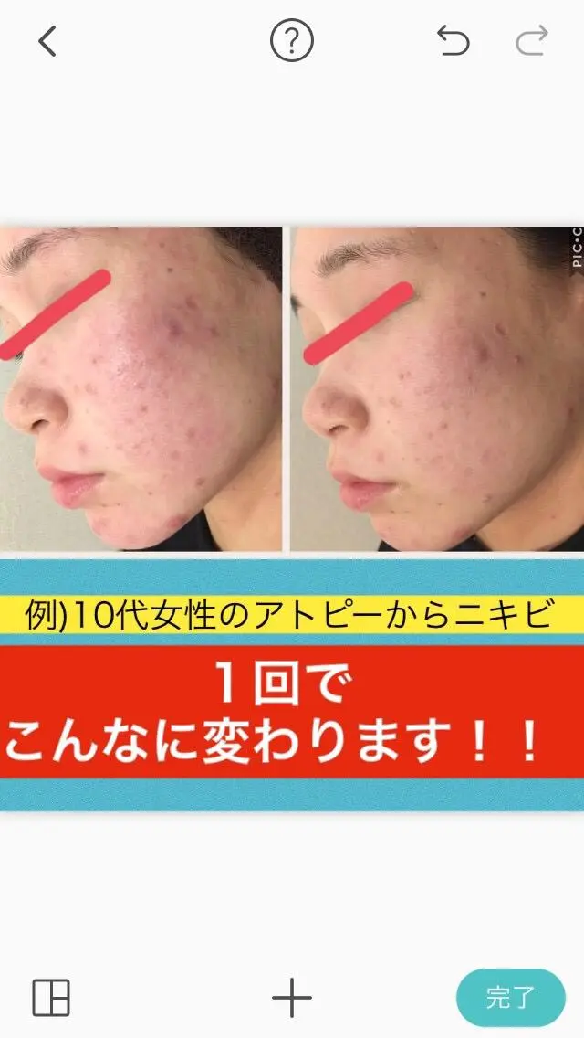 ショート カラー パーマ ヘアアレンジ メンズ キッズ ネイル マツエク・マツパ ニキビ・肌質改善専門 ♡人生が変わるサロンのエステ・リラクイメージ